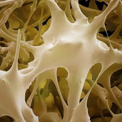 Nova terapija matičnim ćelijama pomaže u tretmanu osteoporoze i obnavljanju kostiju
